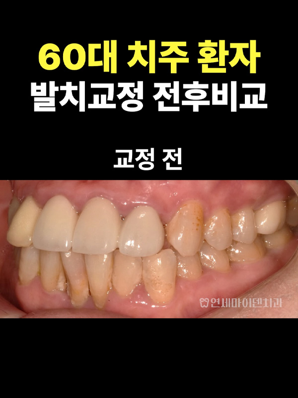 교정케이스24_admin_03.jpg