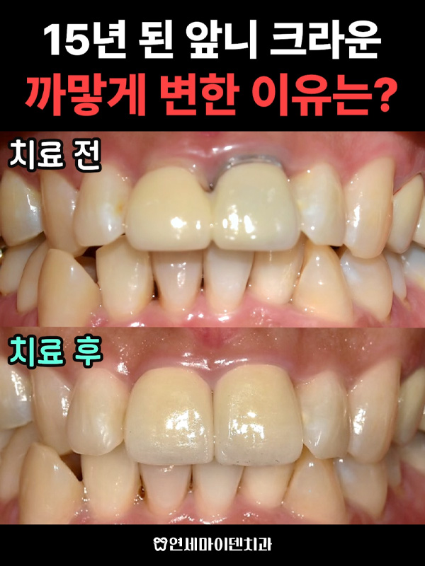 케이스267_admin_1.jpg