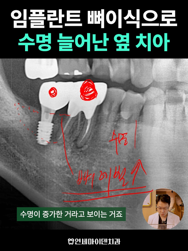 케이스285_admin_1.jpg