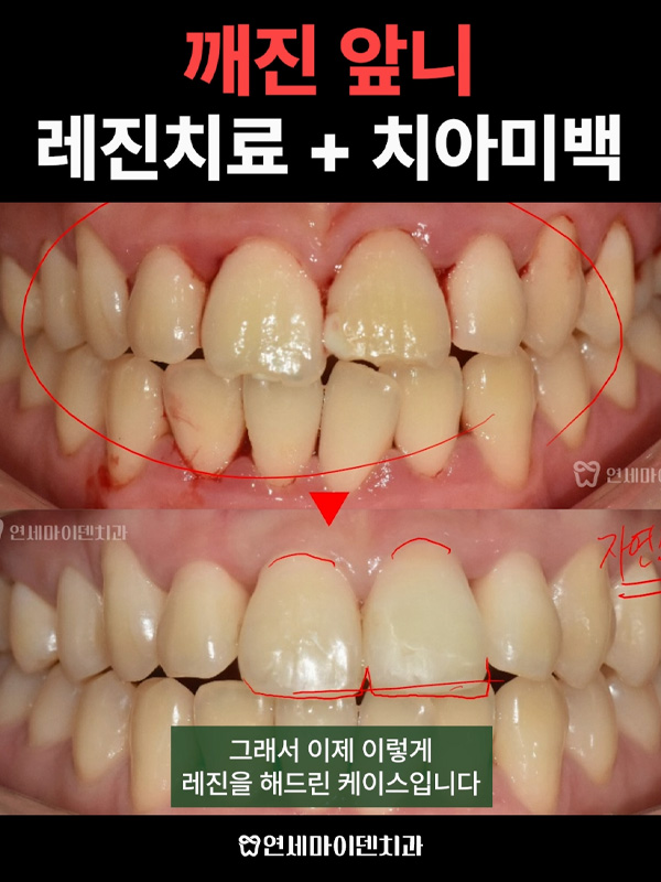 케이스288_admin_1.jpg